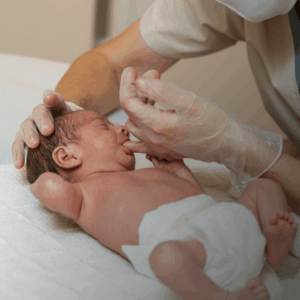 Lรขโฌโขintervento Logopedico nel neonato: gestione dellรขโฌโขallattamento e delle disfunzioni orali